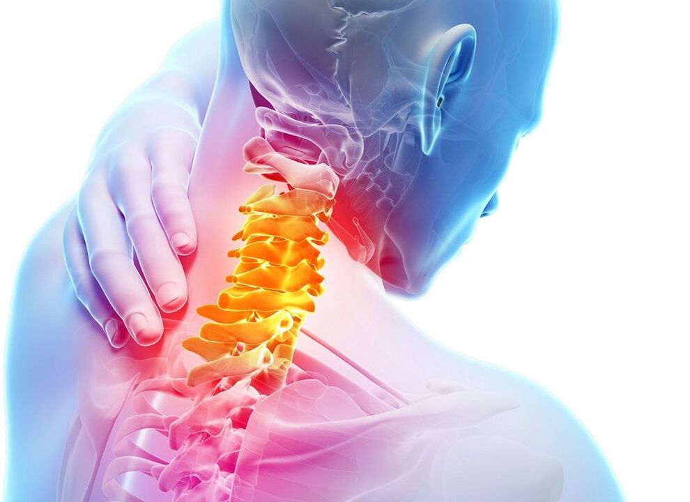 localization of osteochondrosis